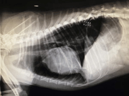 Harris' x-ray