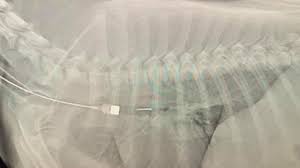X-ray showing thumb tack